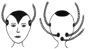 Migrainecode deel 1